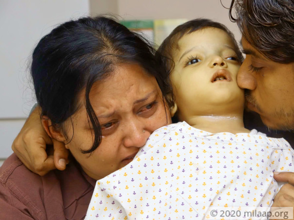 Help Syed Abram Fight Osteopetrosis
