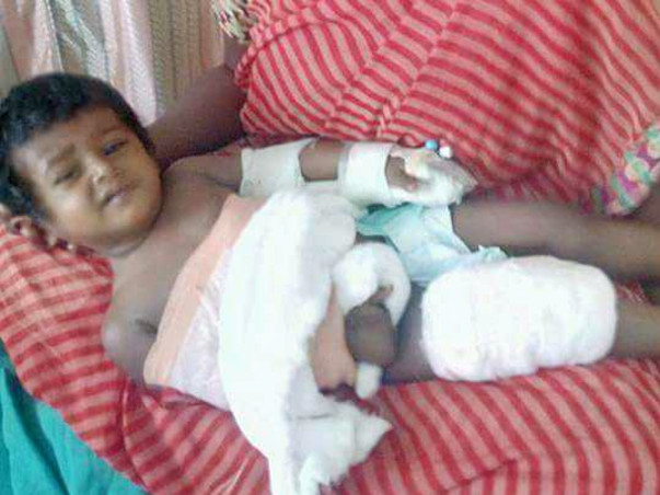 Help Little Madhulika Get A Hand