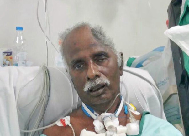 Help My Uncle To Live