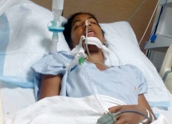 Help Jincy Come Out Of Ventilator Support