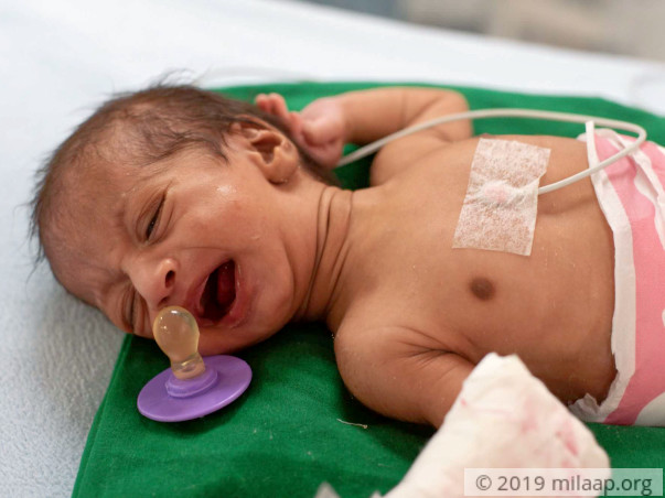 Baby of Jyoti needs your help to survive