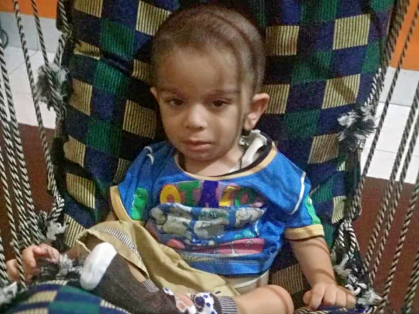 Help My Son Burhanuddin Fight Leigh Syndrome (A Neurological Disorder)