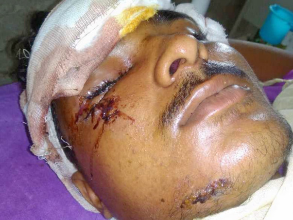 Help Neeraj Recover From An Accident