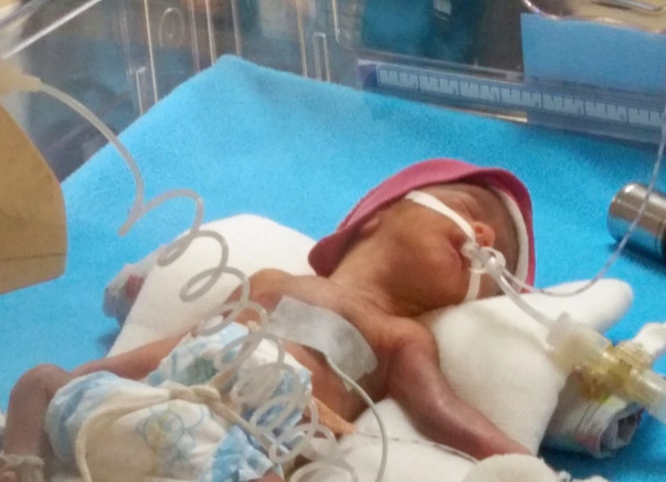Help for extremely Premature baby