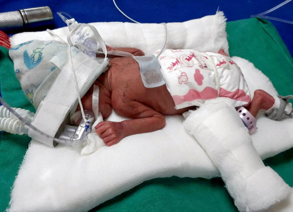 HELP FOR SAVE MY BABY GIRL