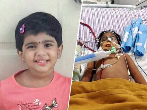 You Can Save 3-year-old Sandhiya Who Is On Artificial Lung Machine