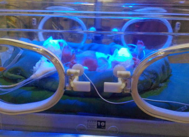 This New-Born Is Fighting Infections And Need Your Help To Stay Alive