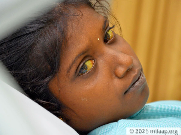 Sivaranjini needs your help to undergo Liver transplant