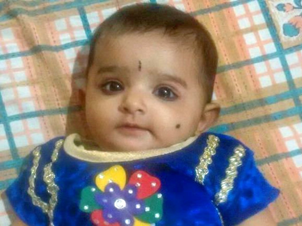 Help Jeevitha(6 Month Old Baby)suffering From Atypical HUS