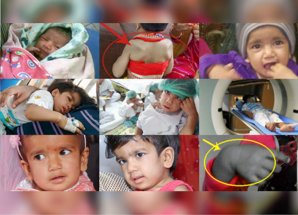 Help My Daughter Live #HelpSaveAvishi