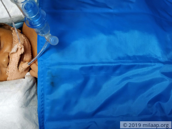 Baby of Parvathi needs your help to survive