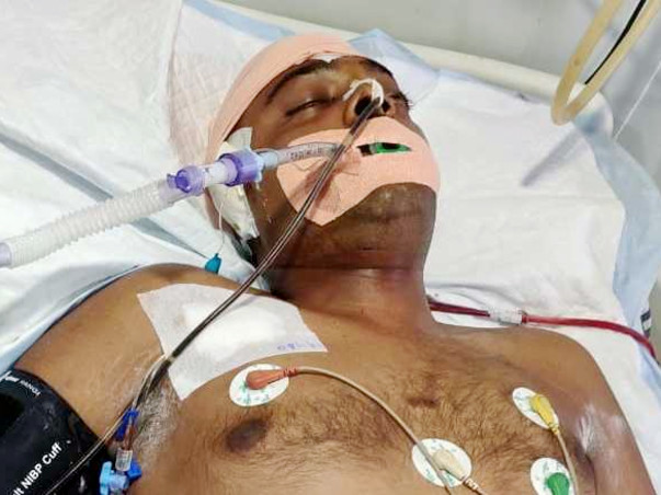 My 25 year old cousin is struggling with Head injury and neurological shock, help him