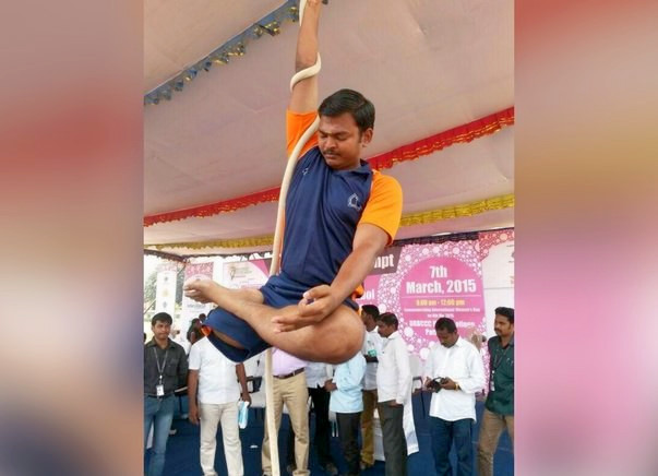 Help This Multi-Talented Man Walk Again With An Artificial Limb.