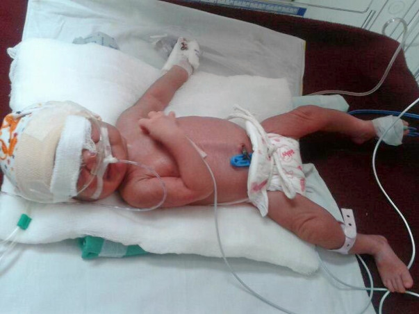 Please help my 1-week-old baby fighting for his life