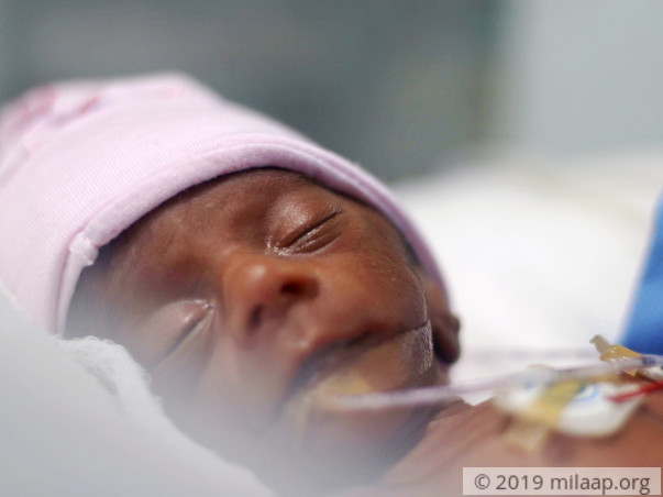 Help Durga's Premature Babies
