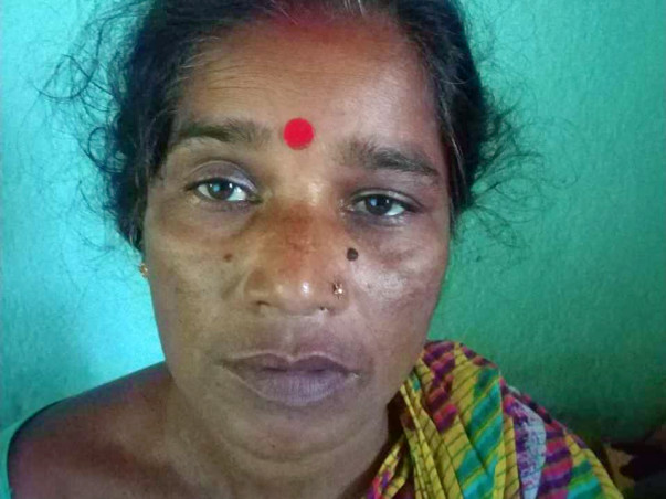 Help Shakuntala Fighting Colon Cancer