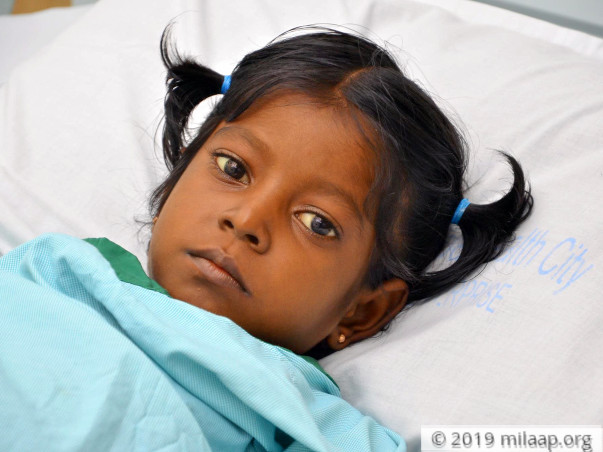 Oviya needs your help to undergo Liver transplant