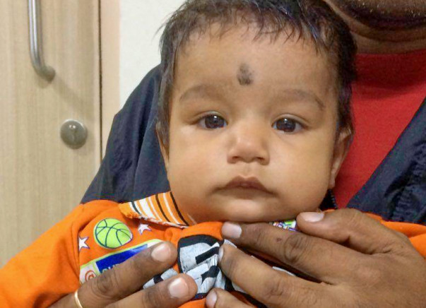 9-Month-Old Baby Needs An Urgent Heart Surgery
