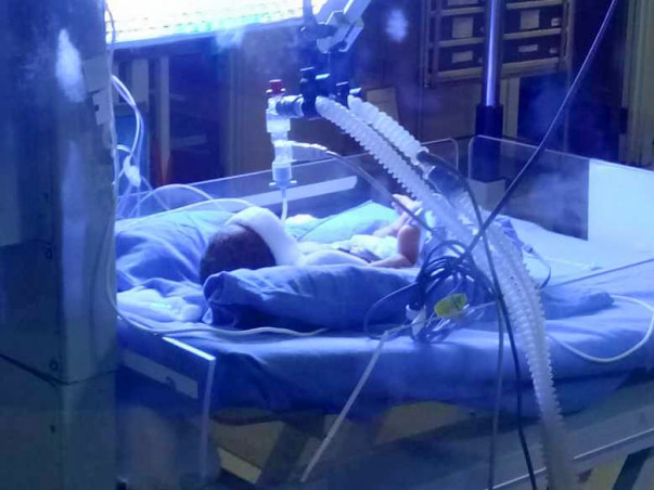 Help my premature baby