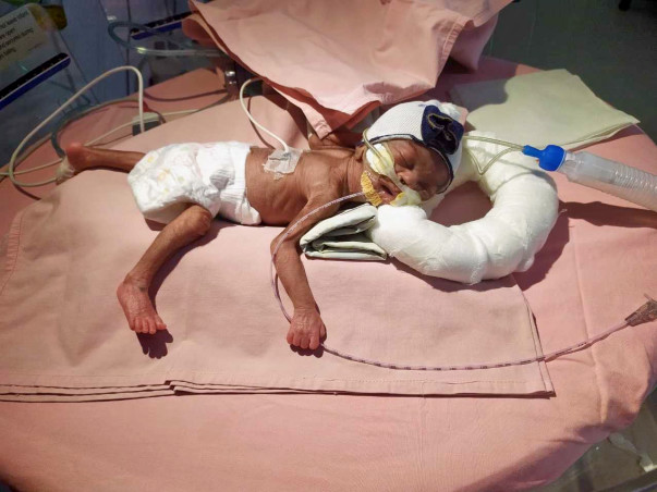 NICU சிகிச்சைக்கு உட்படுத்த மோகனா பிரியாவின் குழந்தையை ஆதரிக்கவும்