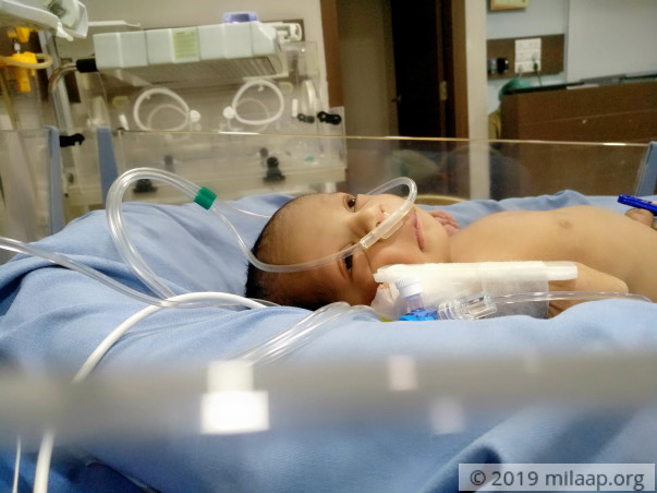 4-day-old Baby Will Suffocate To Death Unless He Has A Surgery
