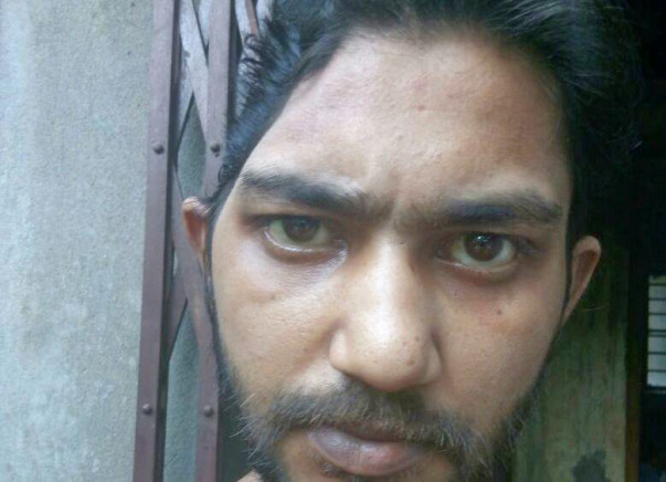Support Suman A 28 years Old Young Man For His Brain Operation