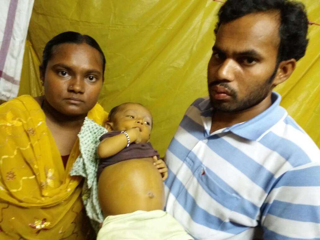 Due to extreme jaundice 6 month baby Jareena has turned all Milaap