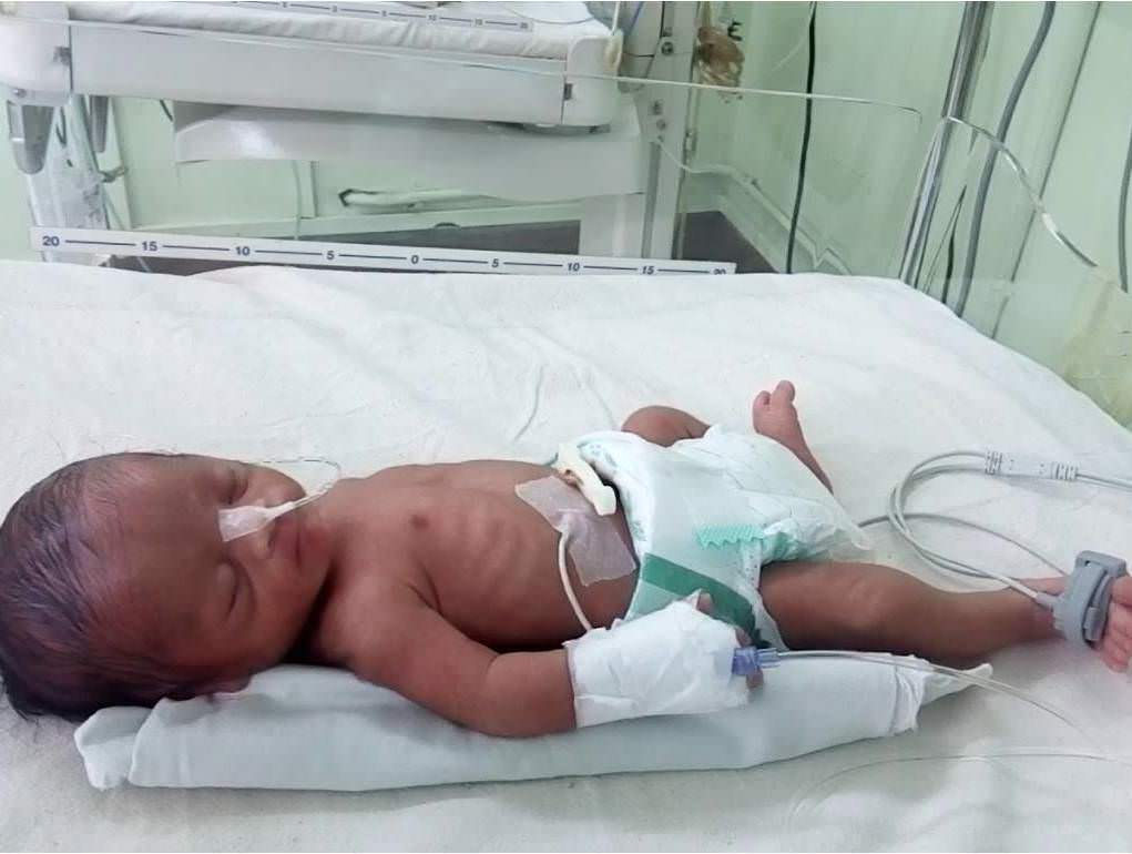 This 4MonthOld Baby Throws Up At Least 8 Times A Day And Is Half The