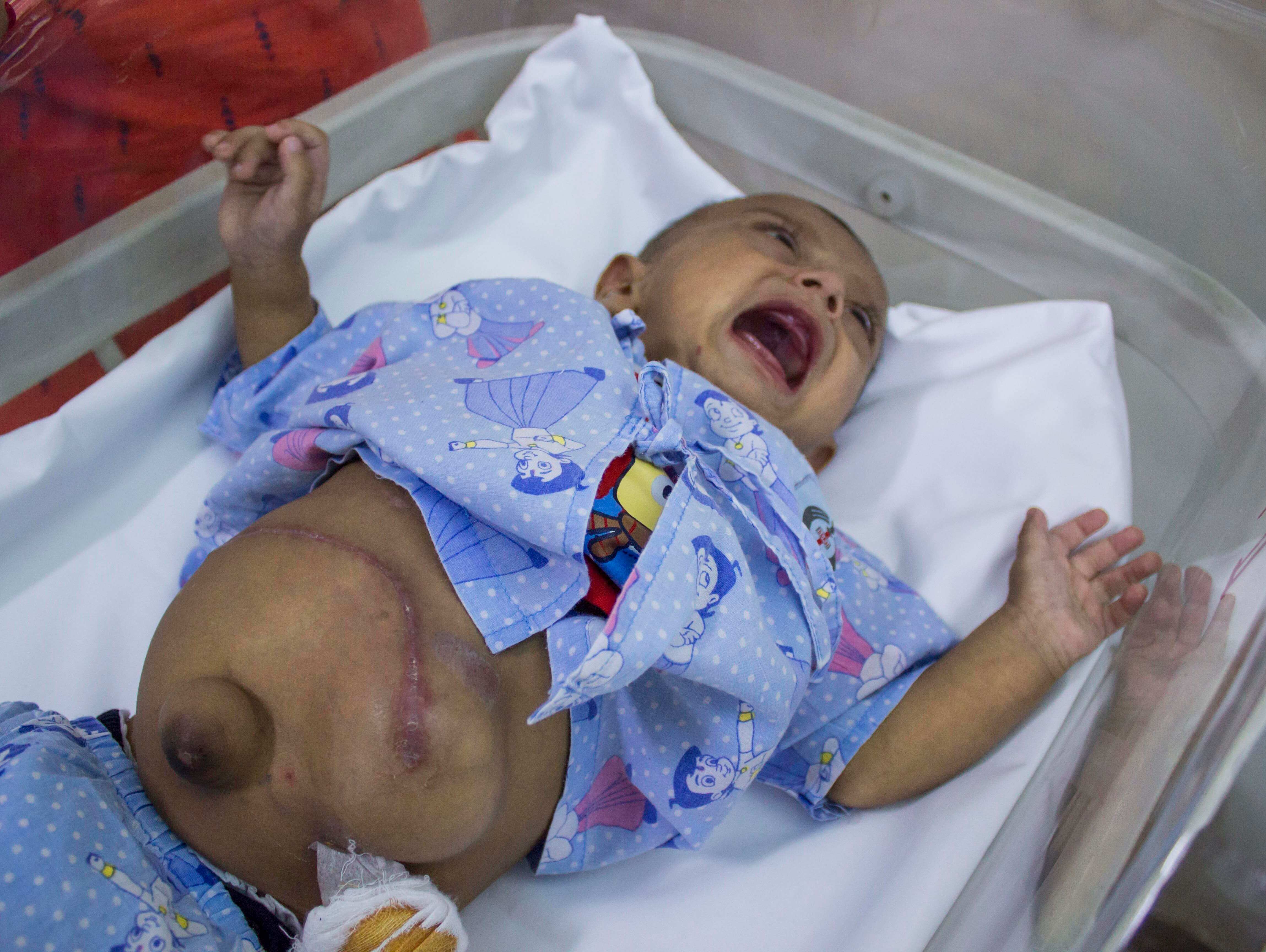 What looked like jaundice was much worse than we thought