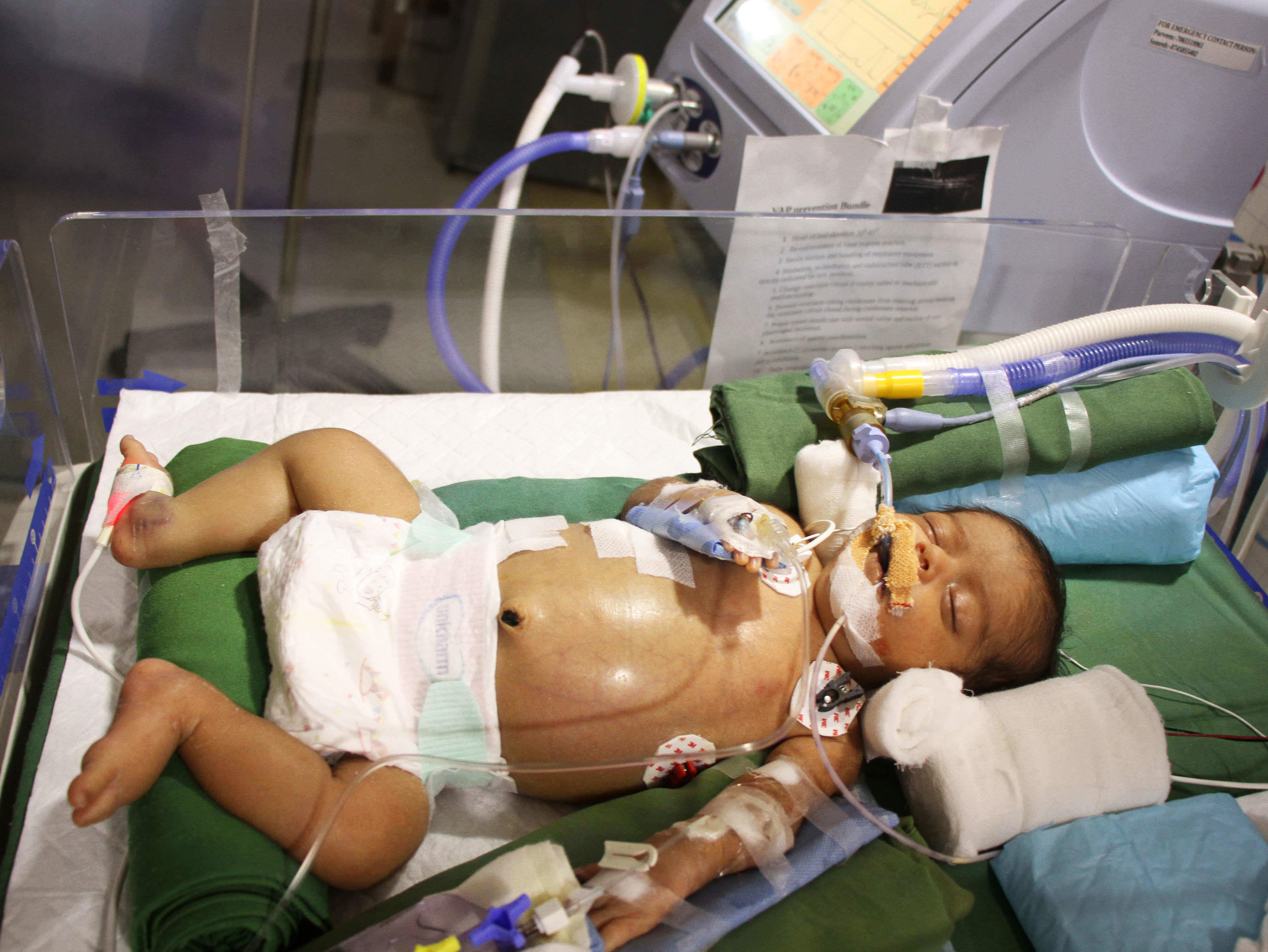 Parents Who Had Not Held Their Newborn Even Once Discovered Milaap