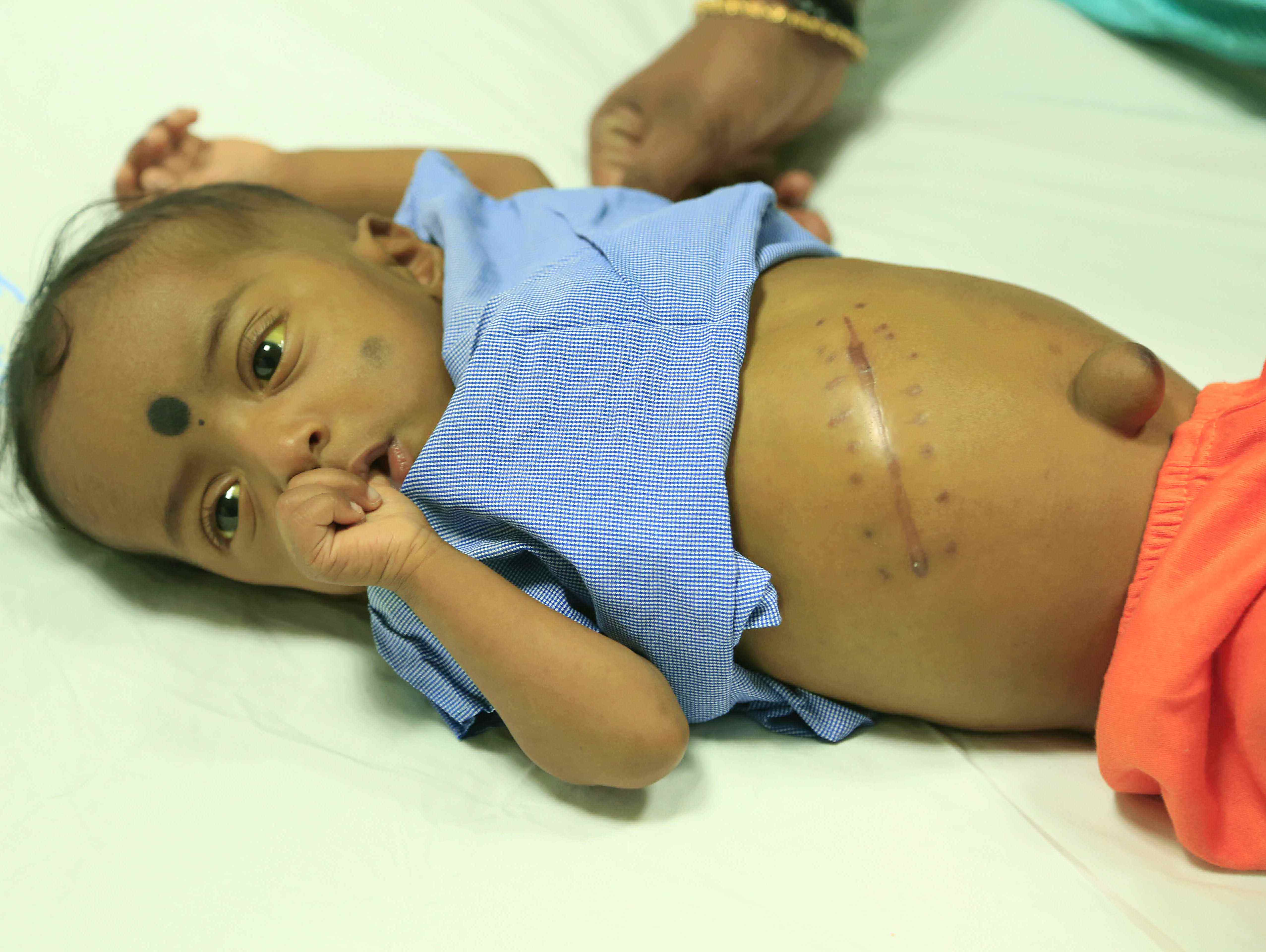 Handicapped Father Works OverTime But Still Cannot Make Milaap