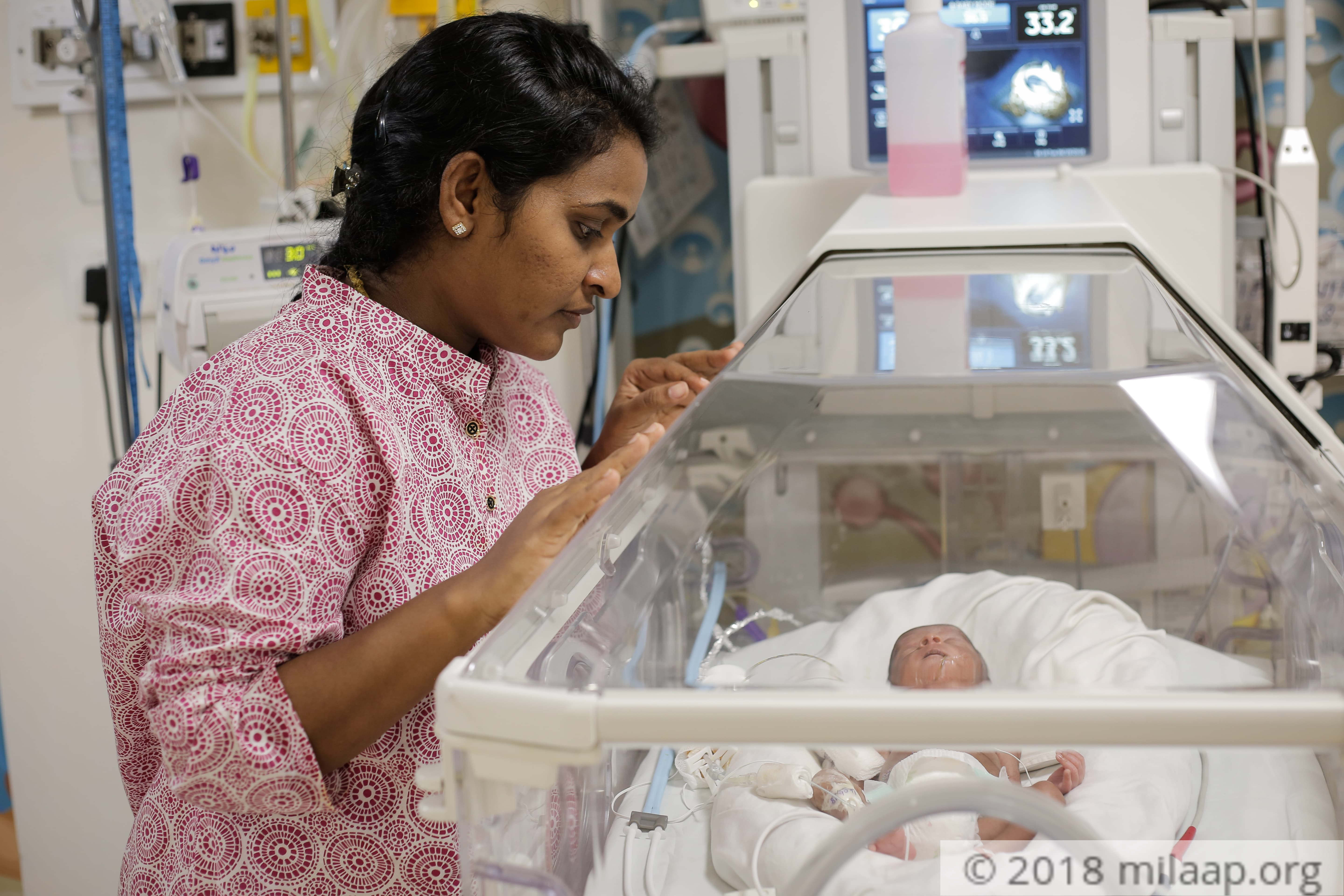 16DayOld Baby Born With A Hole In His Stomach Can Only Feed Milaap