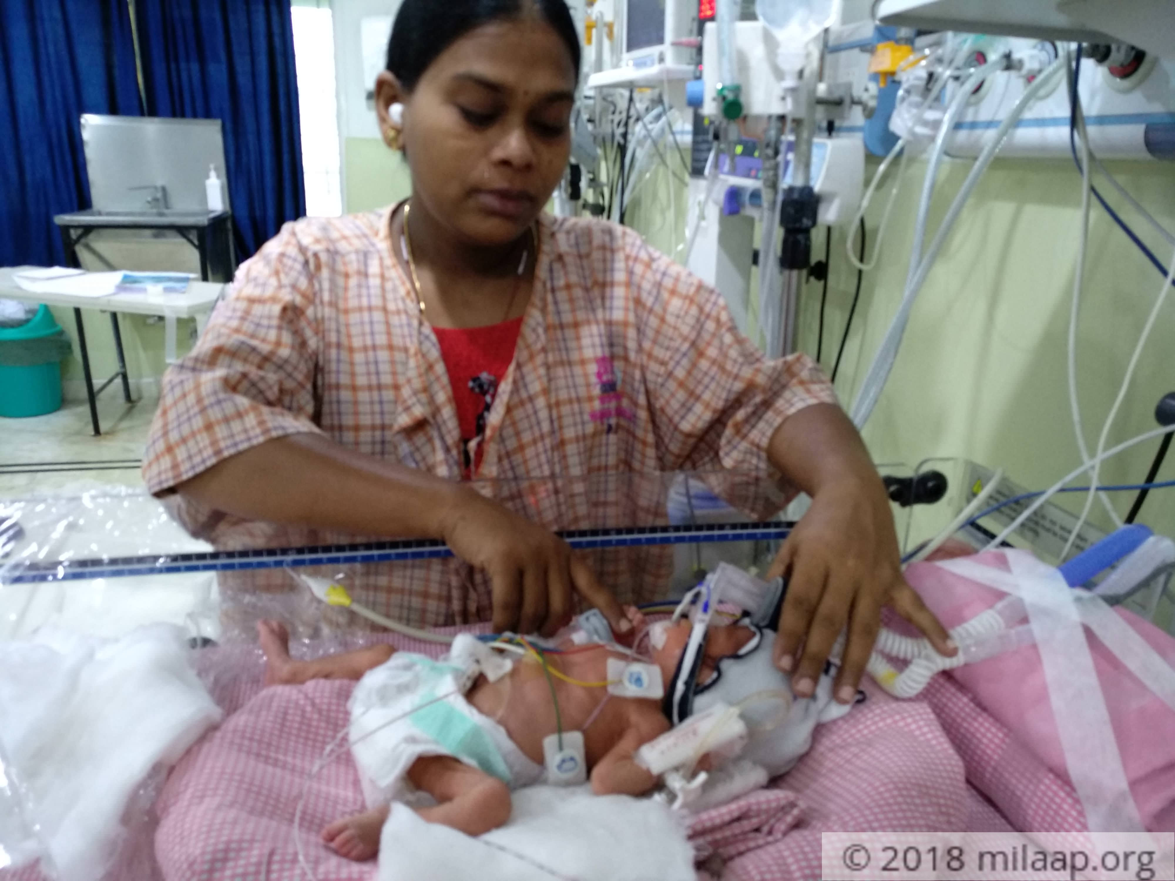 This Premature Baby's Lungs Are Severely Underdeveloped And She Needs
