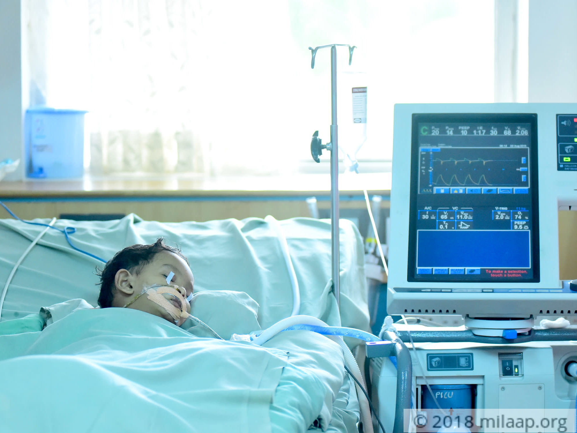 1YearOld Who Accidentally Swallowed Eucalyptus Oil Will Not Milaap